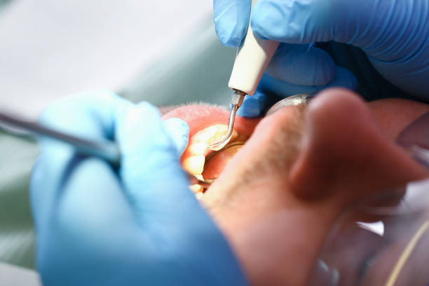 Best Emergency Tooth Extraction  in Manor, TX