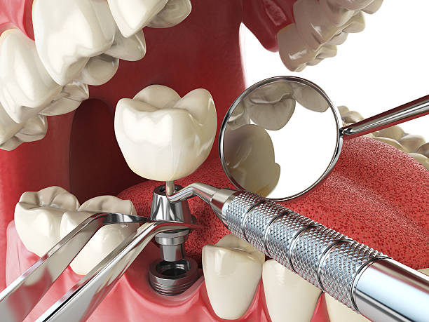 Best Knocked-Out Tooth Emergency  in Manor, TX